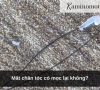 Mất chân tóc có mọc lại không?