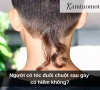 Người có tóc đuôi chuột sau gáy có hiếm không?