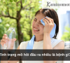 Tình trạng mồ hôi đầu ra nhiều là bệnh gì?