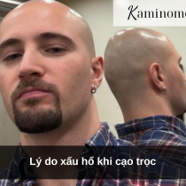 Lý do xấu hổ khi cạo trọc
