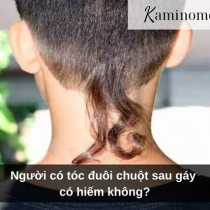 Người có tóc đuôi chuột sau gáy có hiếm không?