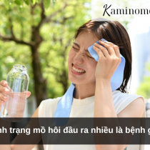 Tình trạng mồ hôi đầu ra nhiều là bệnh gì?