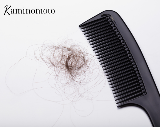 Cách phát hiện bệnh rụng tóc 