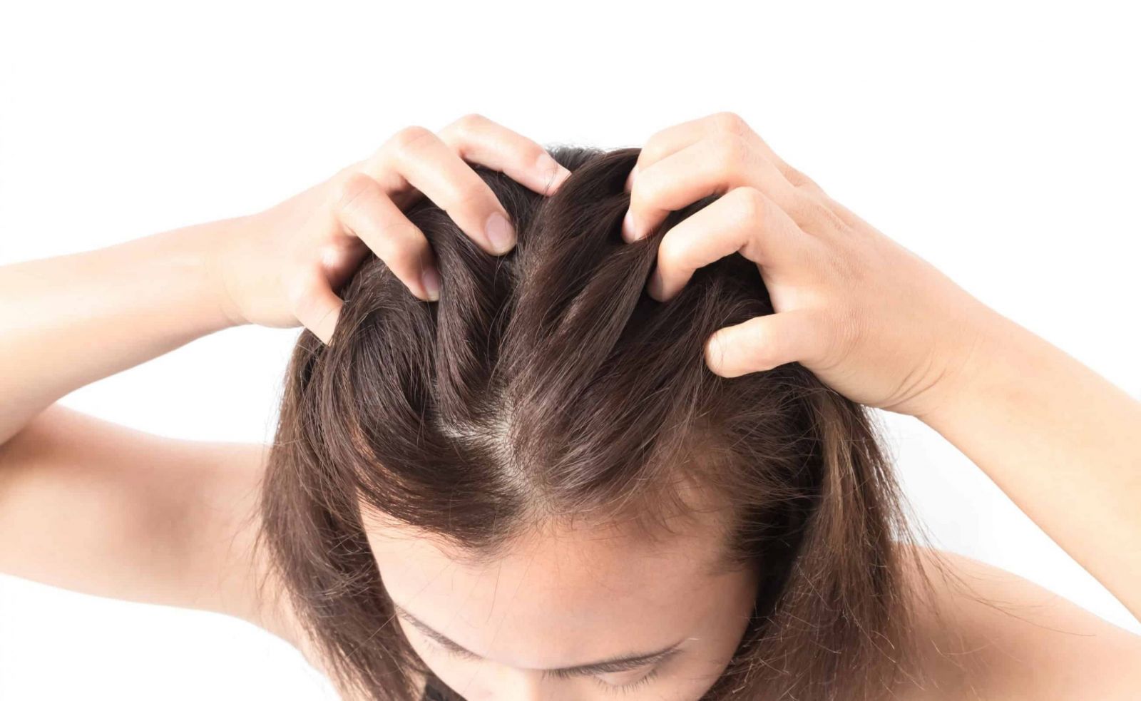 Tổng hợp những cách trị ngứa da đầu và rụng tóc hiệu quả